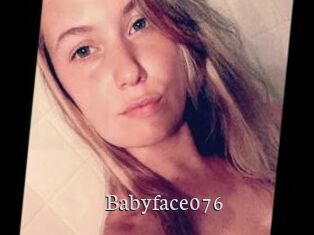 Babyface076